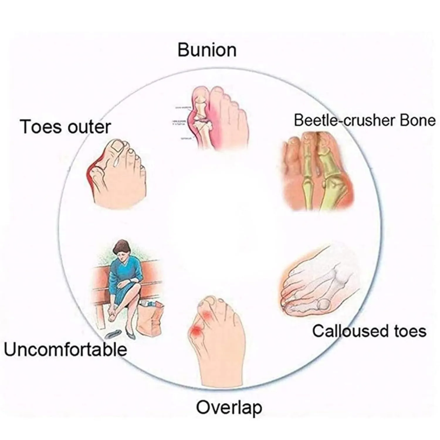 Breathable Bunion Corrector Sandals Men, Summer Lightweight Men's Sandals Bunion Relief(Black,8)